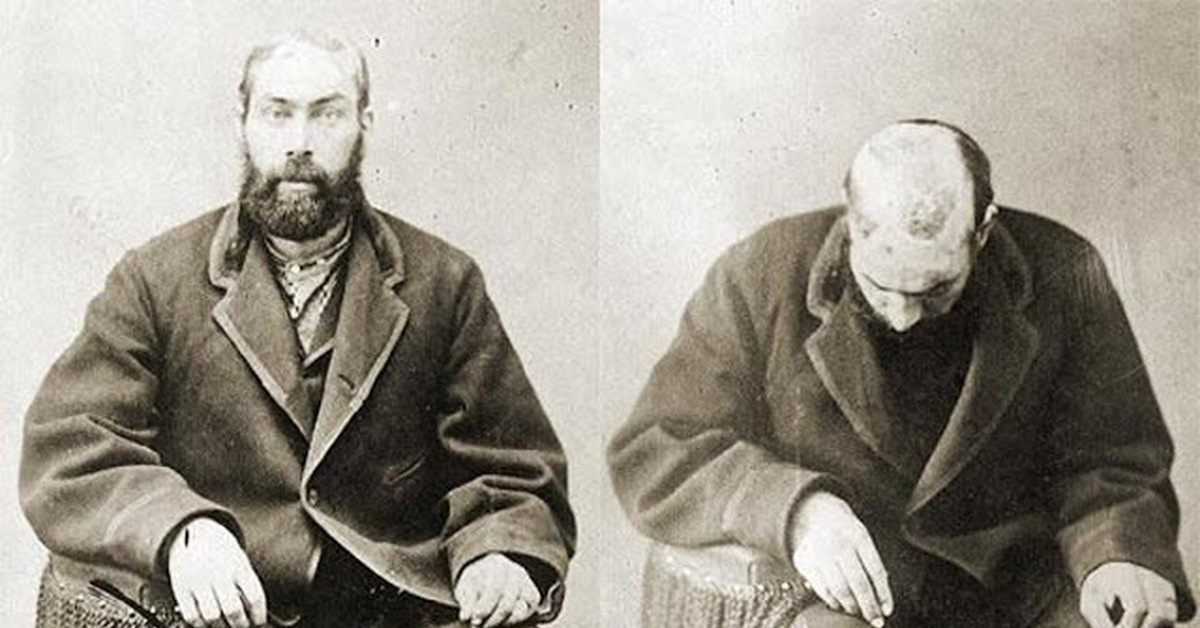 Снятие скальпа индейцами. Что значить снять скальп. Снятие скальпа индейцами. Что значить снять скальп. Коренные американцы скальп.