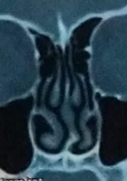      ,   , ,  , , , 