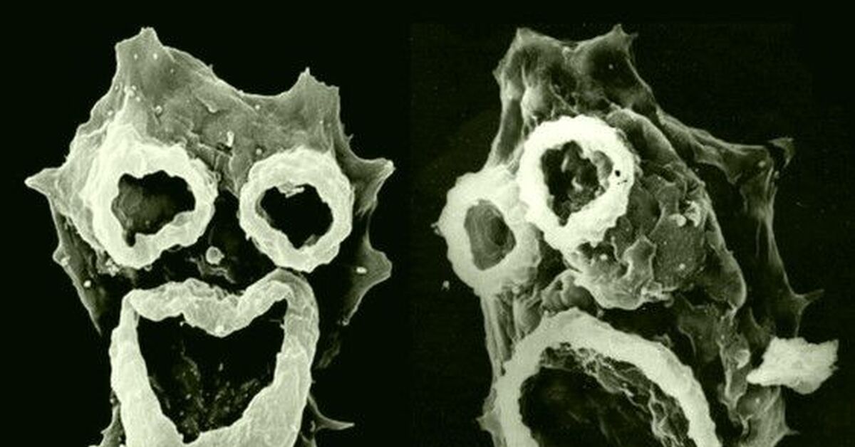 Brain eating amoeba. Амеба неглерия Фоулера.