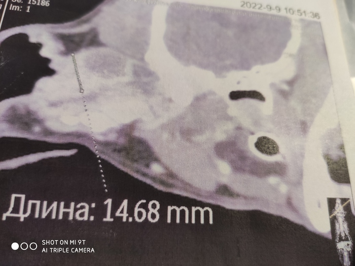 Операция по удалению ушной раковины собаке