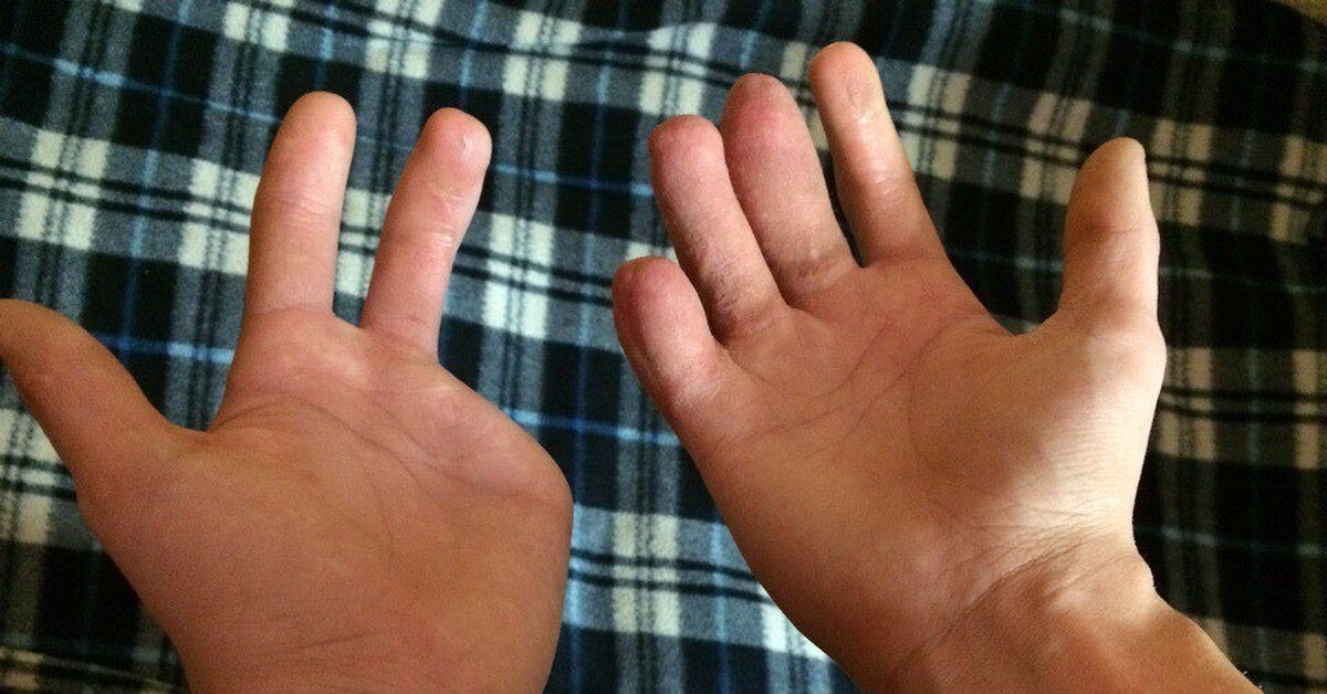 Три пальца на руке фото