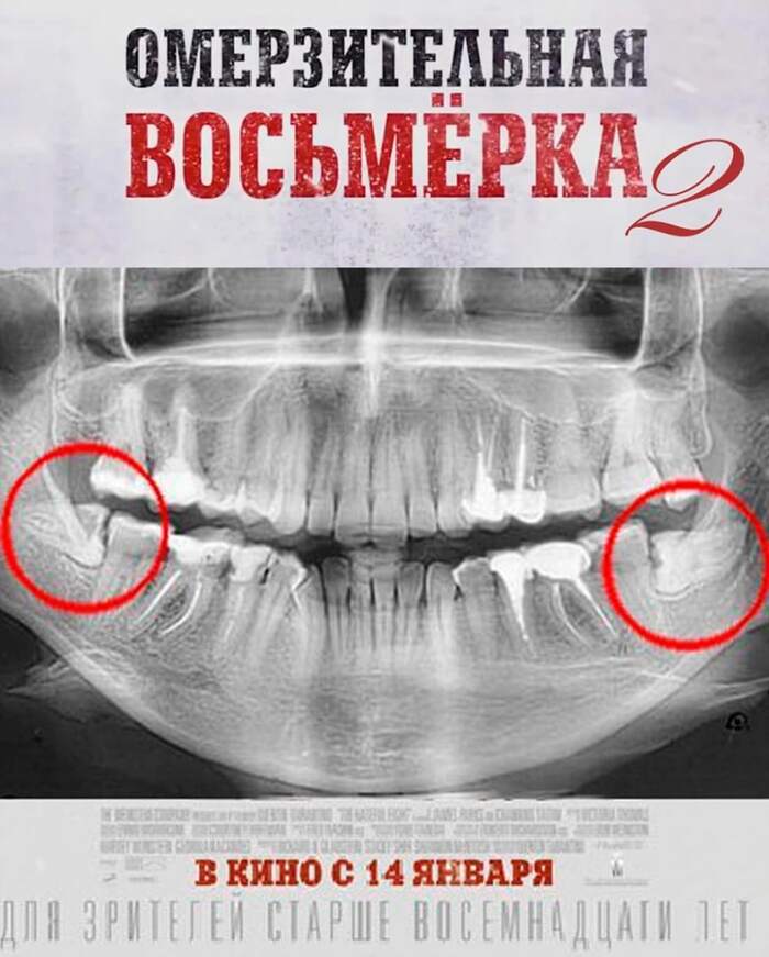 Омерзительная восьмёрка