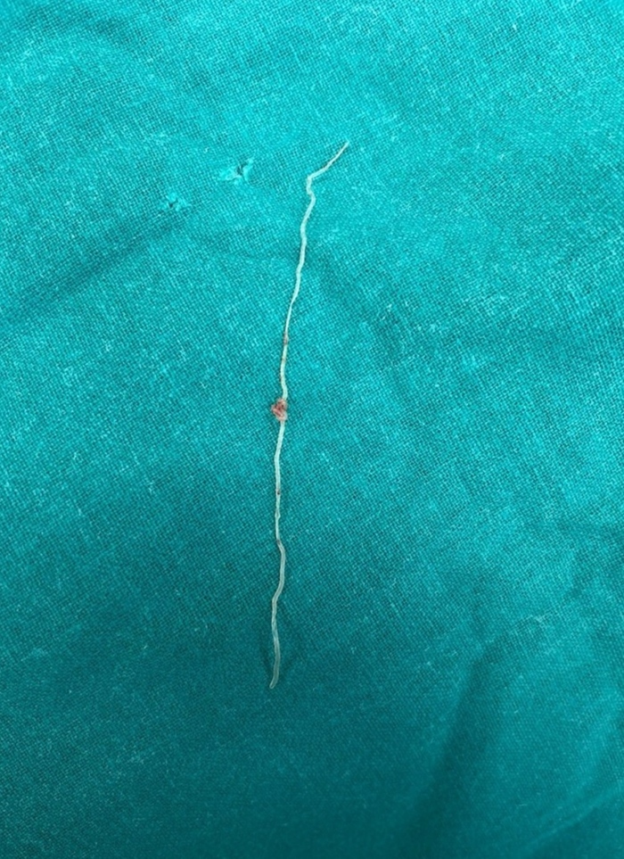 12-ти сантиметровый глист | Пикабу