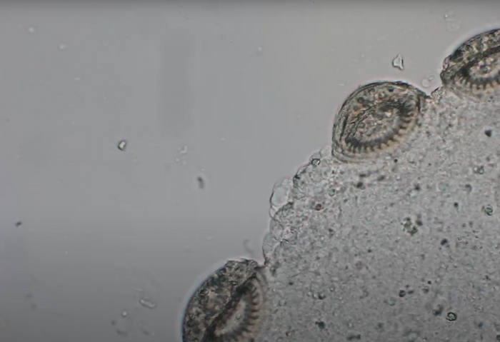 Инфузория паразит (Триходина) под микроскопом Микроскоп, Биология, Научпоп, Исследования, Наука, Длиннопост