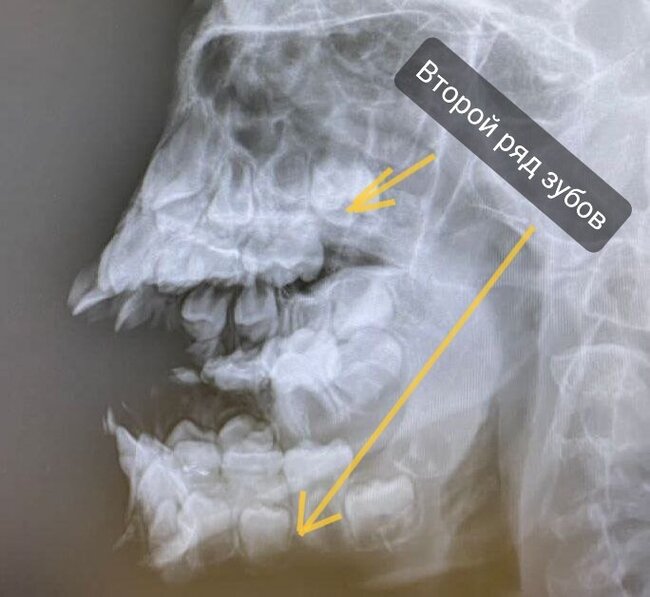 Рентгенография | Пикабу