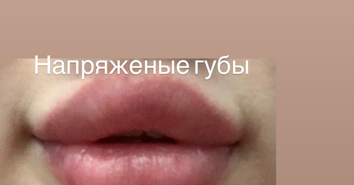Асимметрия губ | Пикабу