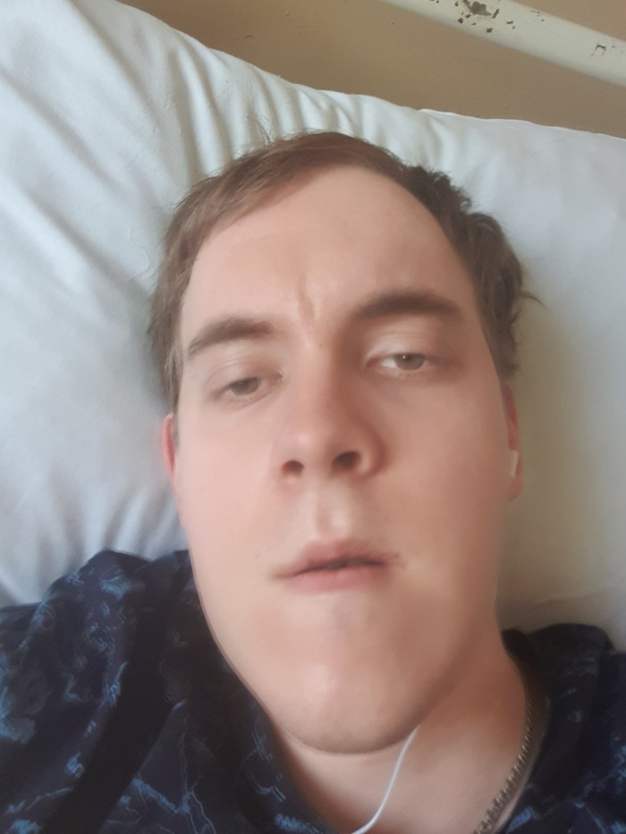 3 день после операции | Пикабу