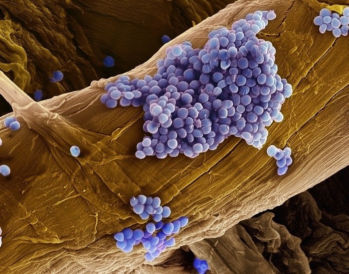 Пиогенный Стрептококк под микроскопом | Пикабу