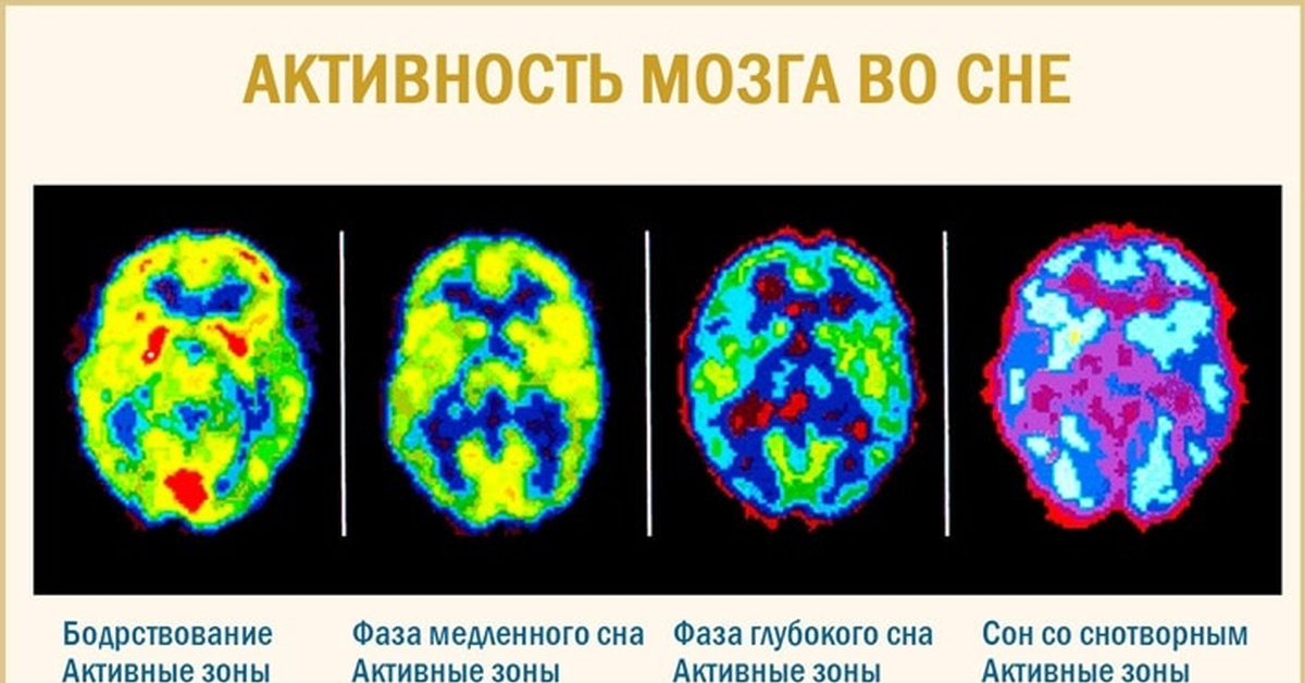Повышение активности мозга. Активность мозга. Активность мозга во время сна. Деятельность мозга во сне. Фазы сна и активность мозга.