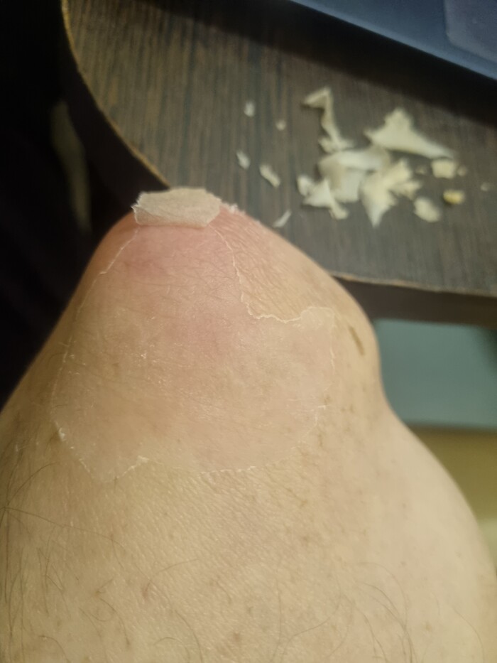 ���� �������������