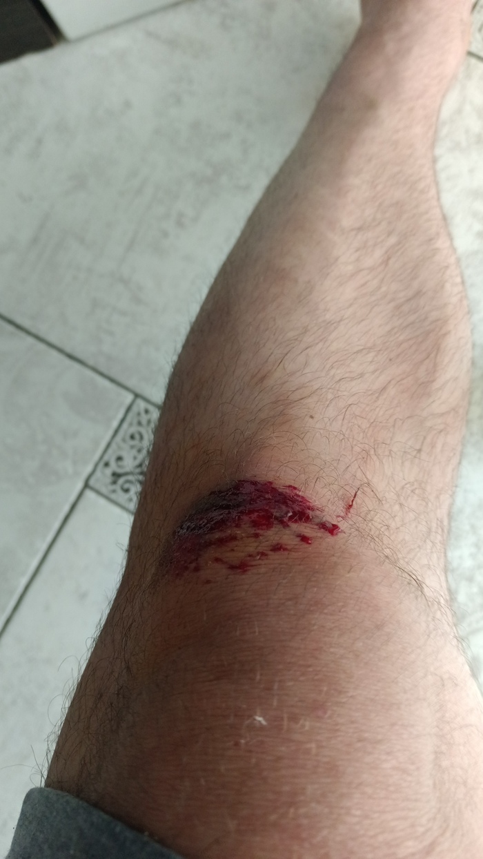 Ободрал коленку как в детстве. Может тоже плюсов получу