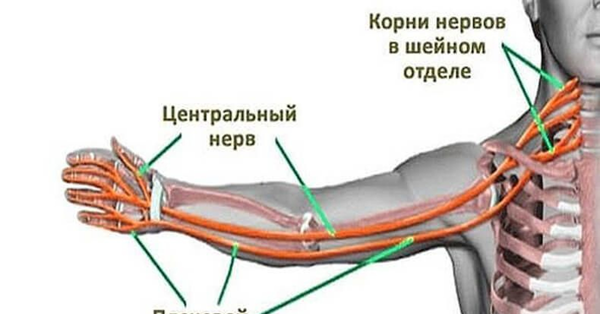 Немеет рука правая причины кисть и пальцы. Немеют руки.