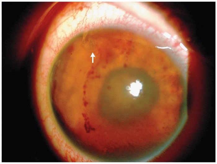 ������������� �������������  ����������