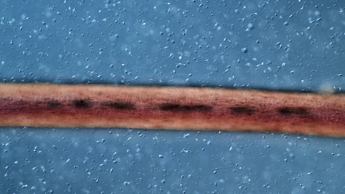 Сперматозоиды на фоне человеческого волоса