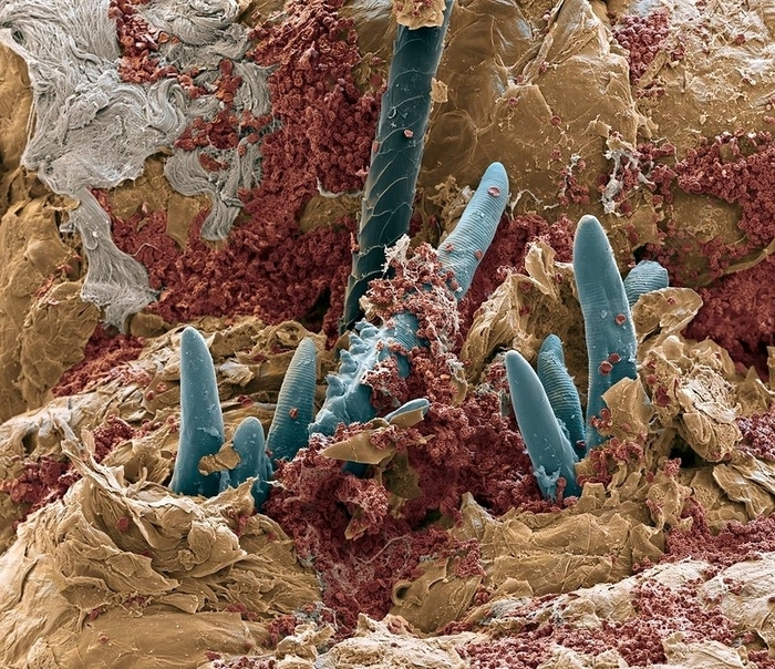 Собачий чесоточный клещ на поверхности волосяного фолликула