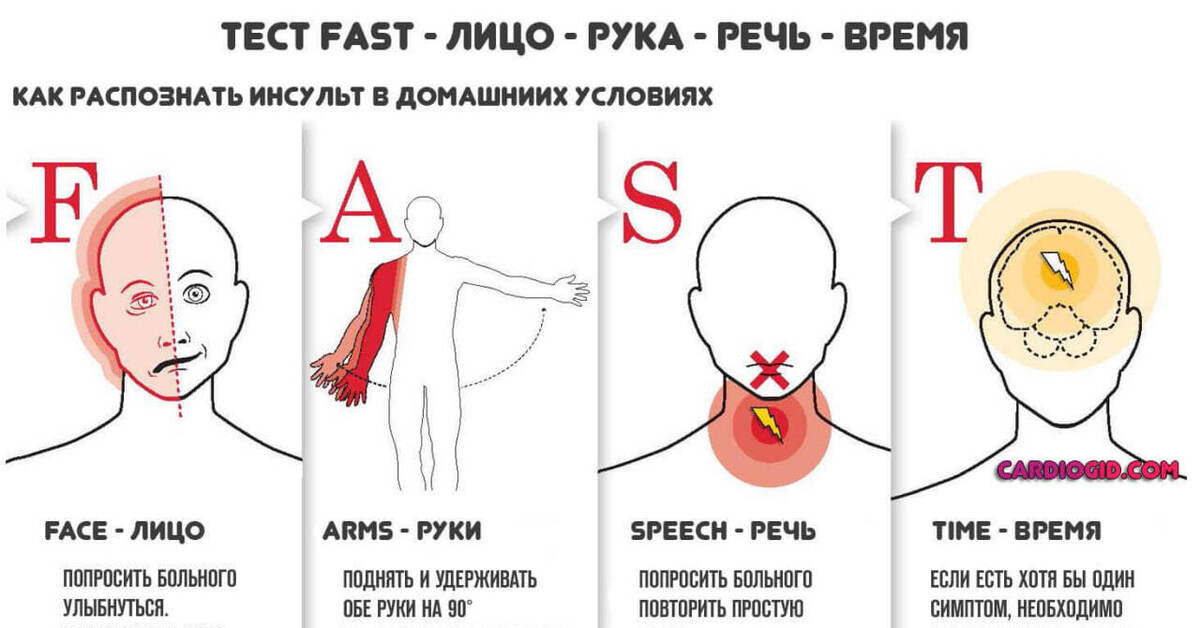 How to stroke. Шкала fast инсульт. Fast Test для определения инсульта. Fast тест при ОНМК. Распознавание признаков инсульта.