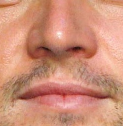 Ноздри в поддержку Olz777