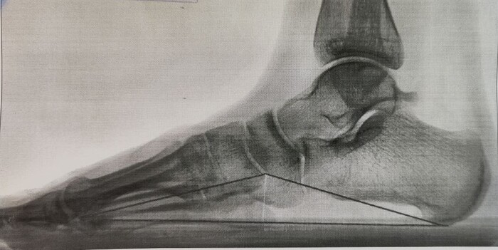 ������ �����