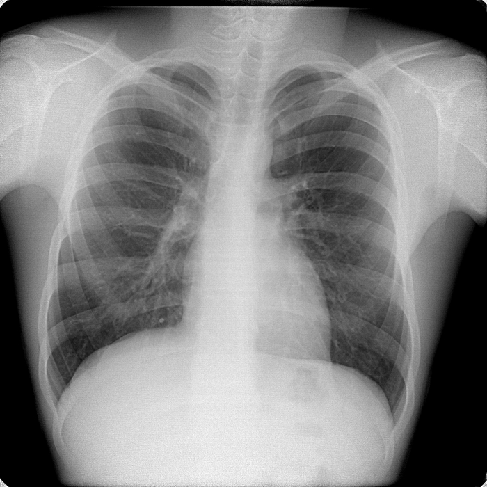 21 -     (, ,  ,  ,   . .).