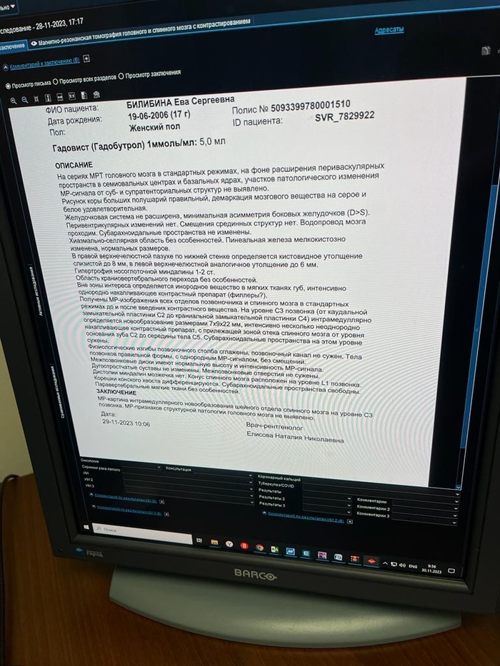 Рассеянный склероз? | Пикабу