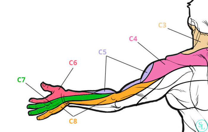 Распространение боли в руке в зависимости от поражения корешка.