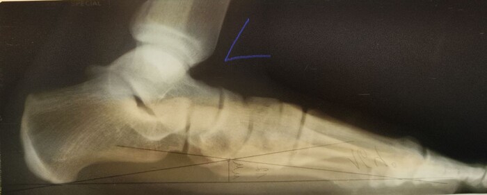 ������ �����