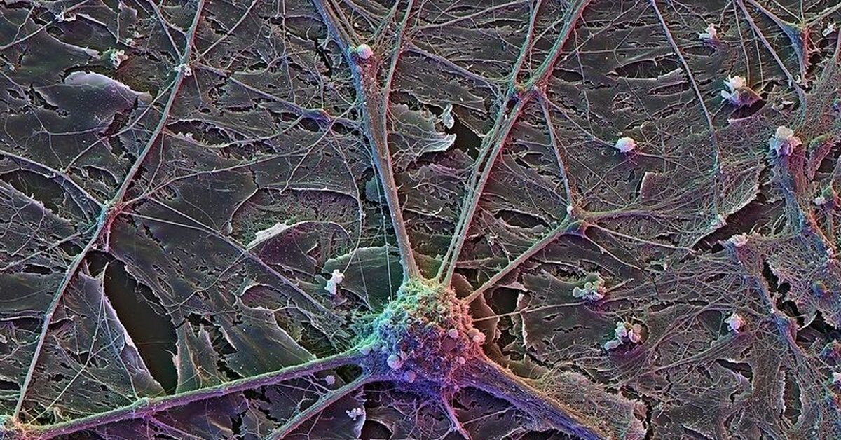 Как называются клетки головного мозга. Нейрон Пуанкаре микрофотография. Нейронные связи под микроскопом. Конфокальная микроскопия мозга. Клетки мозга под микроскопом.