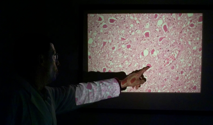 В США «зомби-вирус», заражающий оленей, может перейти на людей