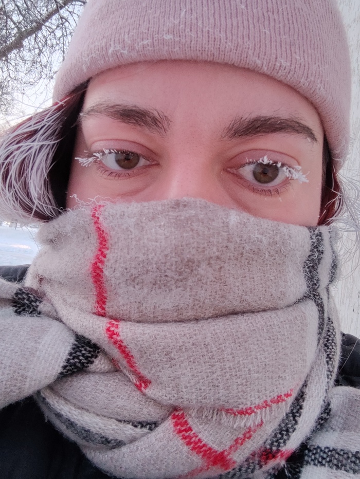 Мешки под глазами от работы)