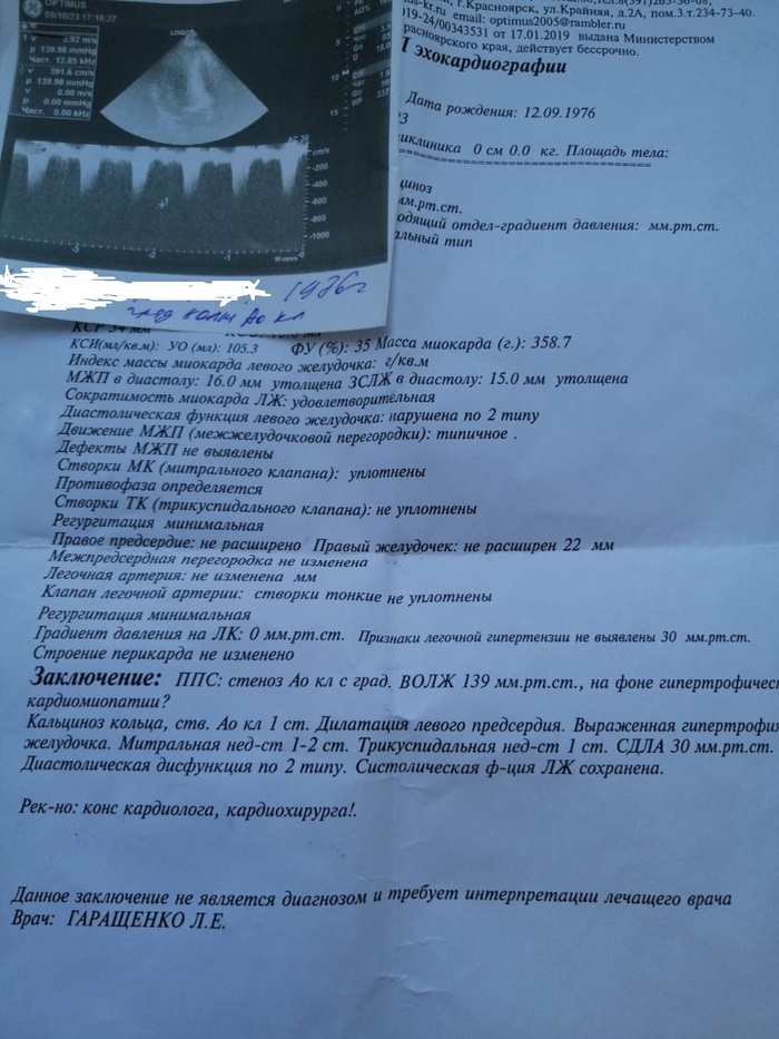 Подскажите по ЭКГ