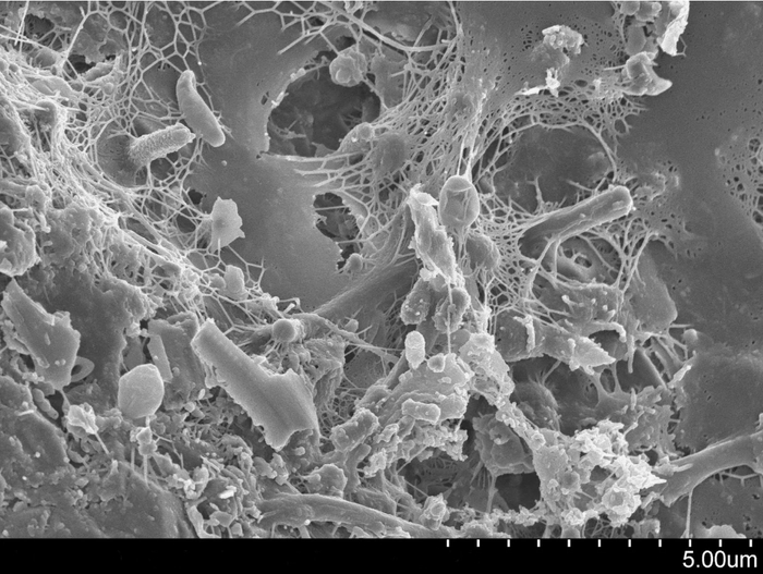 Биоплёнка. Микрофотография. Сканирующий электронный микроскоп