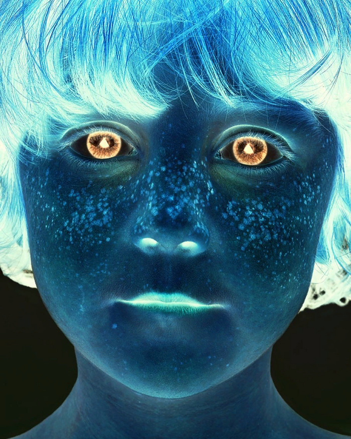 Голубые глаза превратились в огненные у девочки