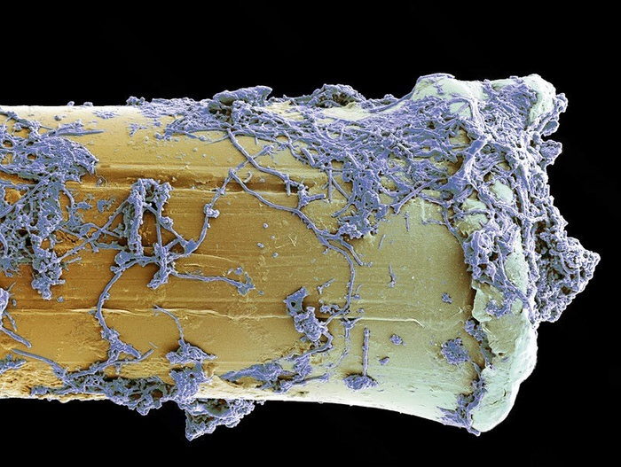  Actinomyces israelii     .   