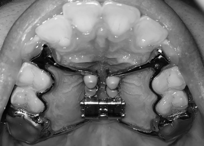 ���� ���������� �������� 