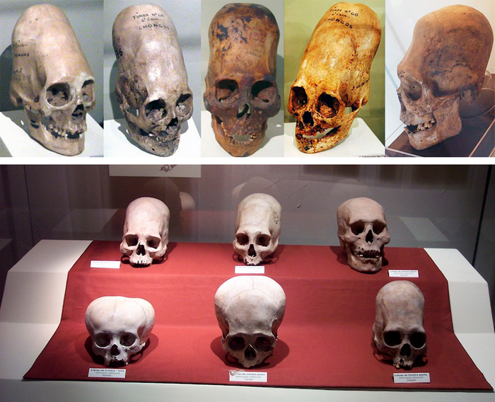Вытянутые и сплюснутые черепа / Сверху: <!--noindex--><a href="https://pikabu.ru/story/inca_special_preinkskie_tsivilizatsii__chast_3_11237794?u=http%3A%2F%2FLatinAmericanStudies.com&t=LatinAmericanStudies.com&h=48269757e6e0a45ce58c1041f6d84805e8fd5b16" title="http://LatinAmericanStudies.com" target="_blank" rel="nofollow noopener">LatinAmericanStudies.com</a><!--/noindex-->, Снизу: Robrrb, CC BY-SA 3.0 DEED