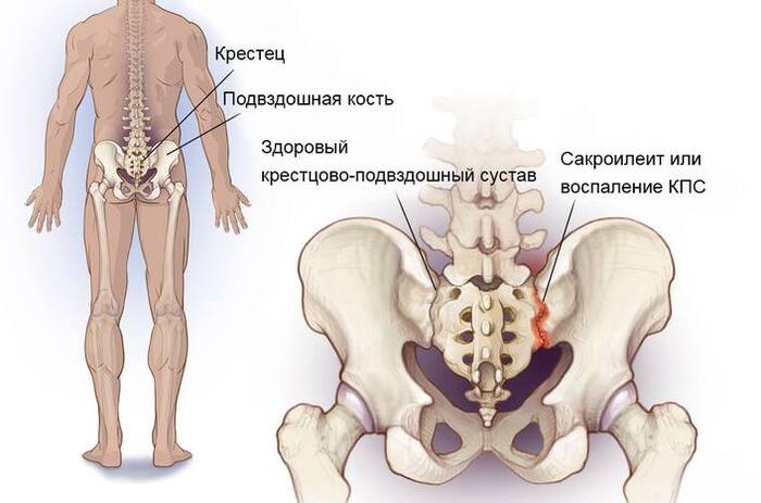 Достаточно близко крестцово-подвздошный сустав расположен к поясничному отделу позвоночника