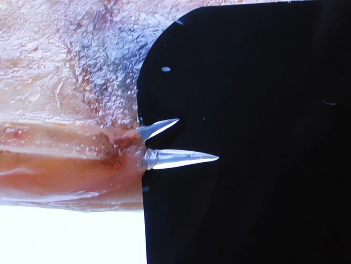 Те самые ядовитые шипики.