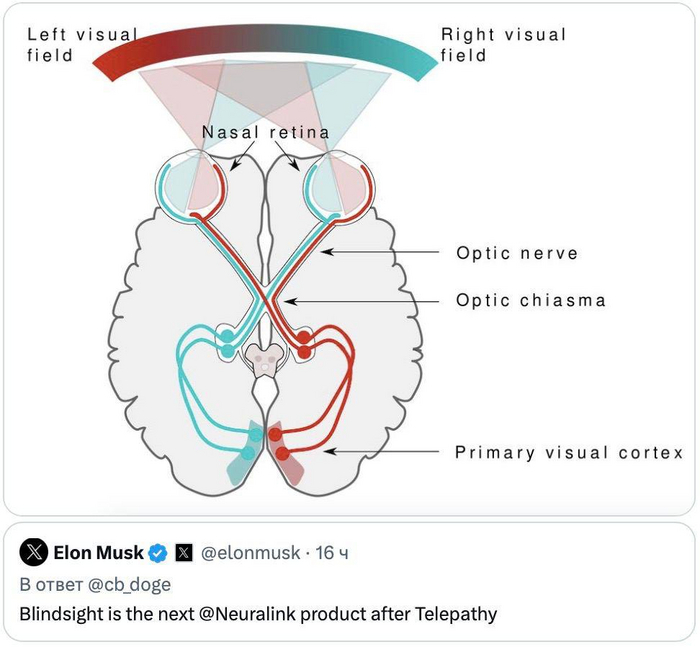 Neurallink Илона Маска показал первого «чипированного» человека, который играет в шахматы силой мысли