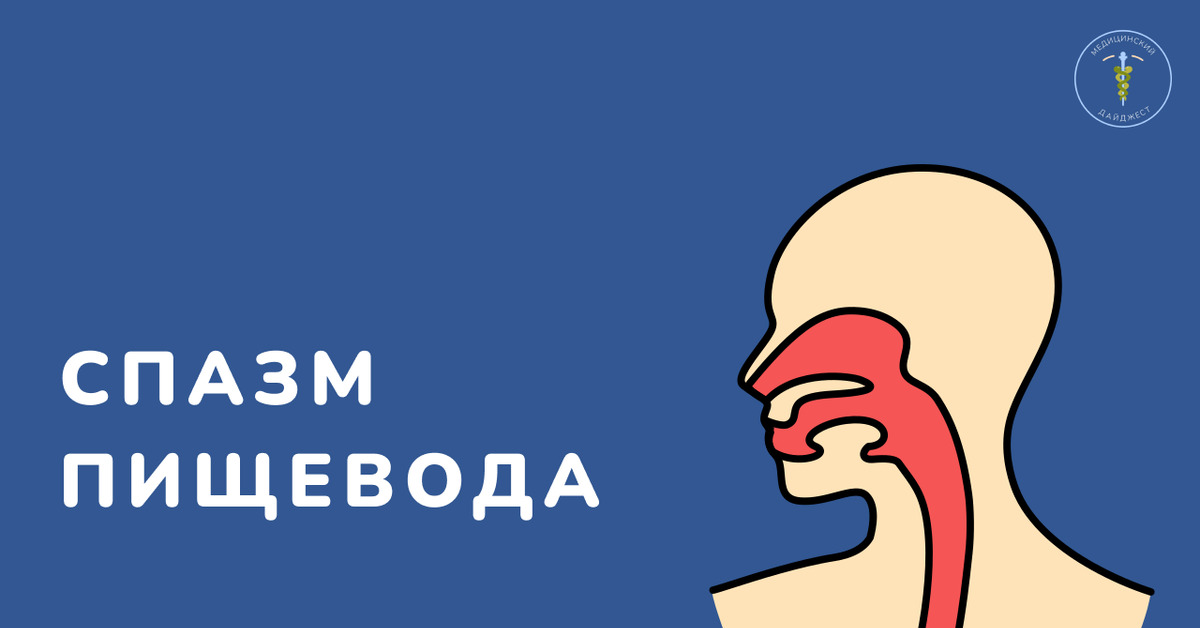 Спазм пищевода | Пикабу