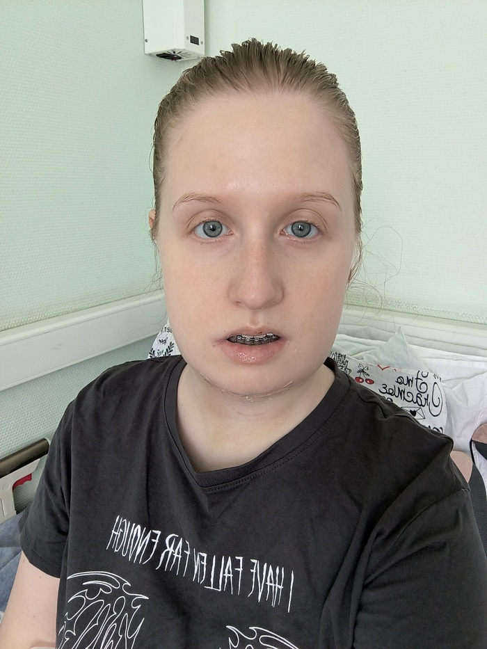 Третьи сутки после операции.