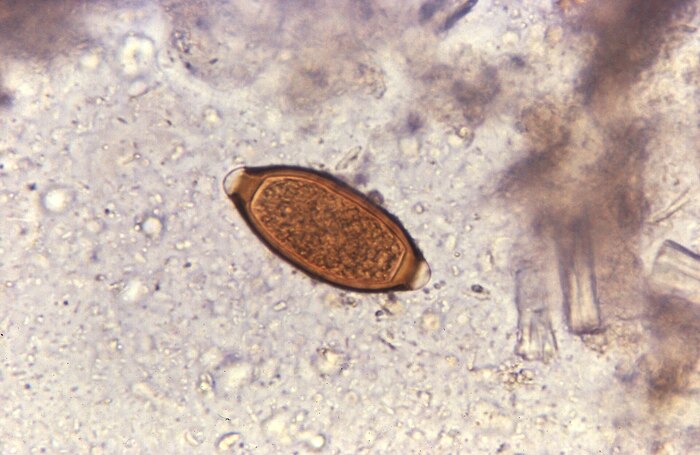 Яйцо власоглава.