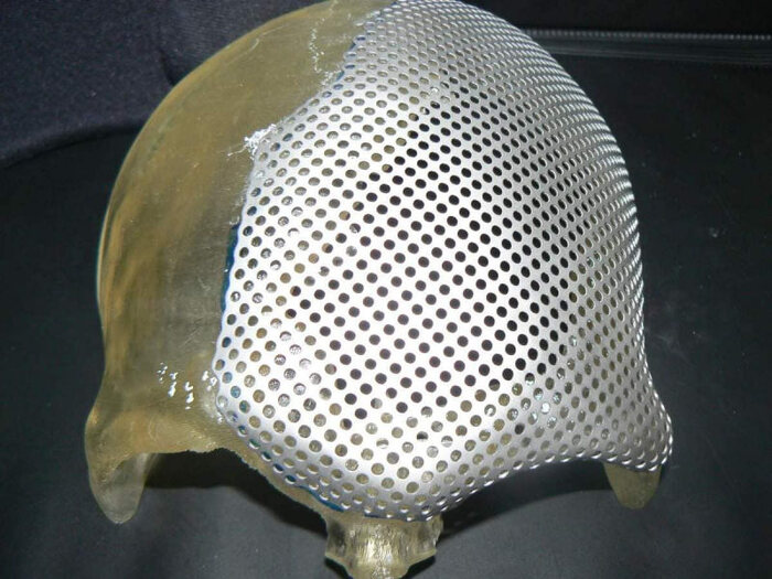 Как я стал инвалидом. часть 6 Больница, Травма, Инвалид, Страшно, Ужас, Длиннопост