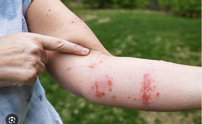 Гугл говорит, может знатно приПлющить. Но меня, хвала Богам, обошло.