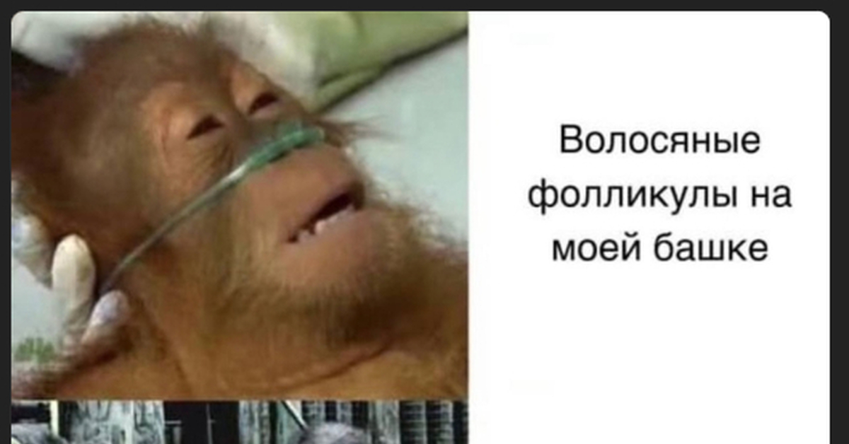 Волосяные фолликулы | Пикабу