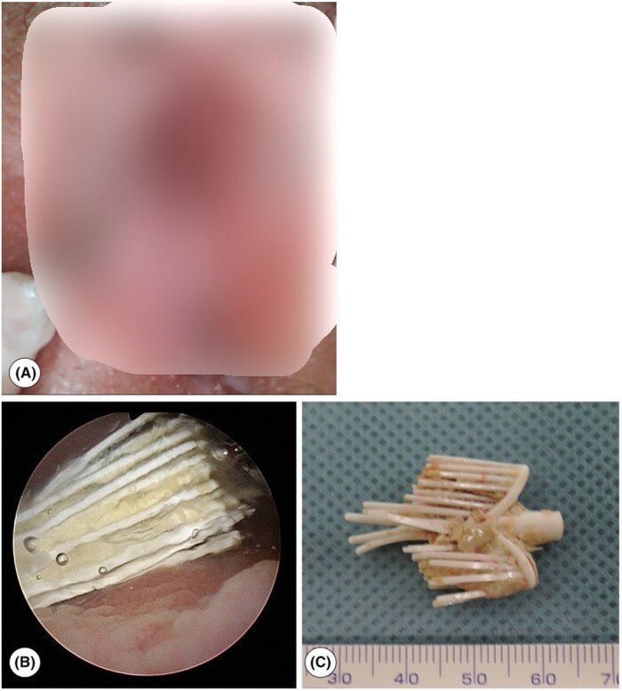 Figure 2.          () (     ).             (). 