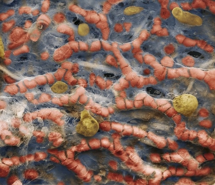 Капилляры в альвеолах. Хорошо видно эритроциты.