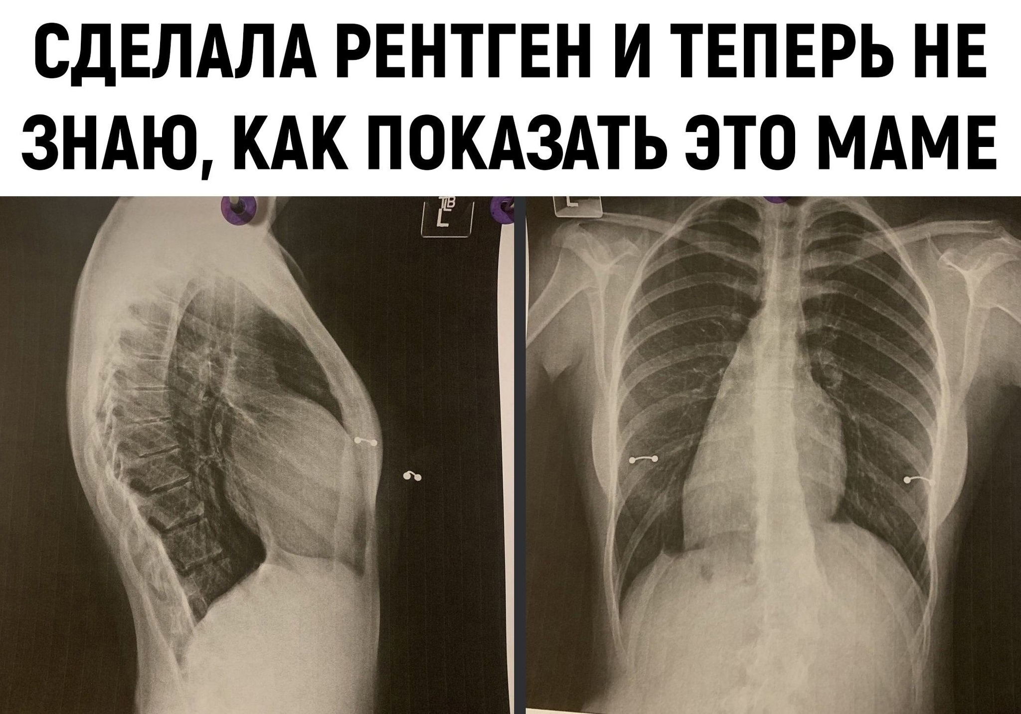 Спалила пирсинг | Пикабу