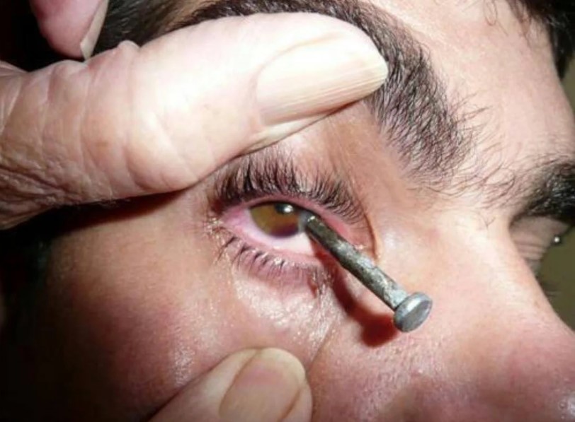 Как проходит лечение травмы глаза