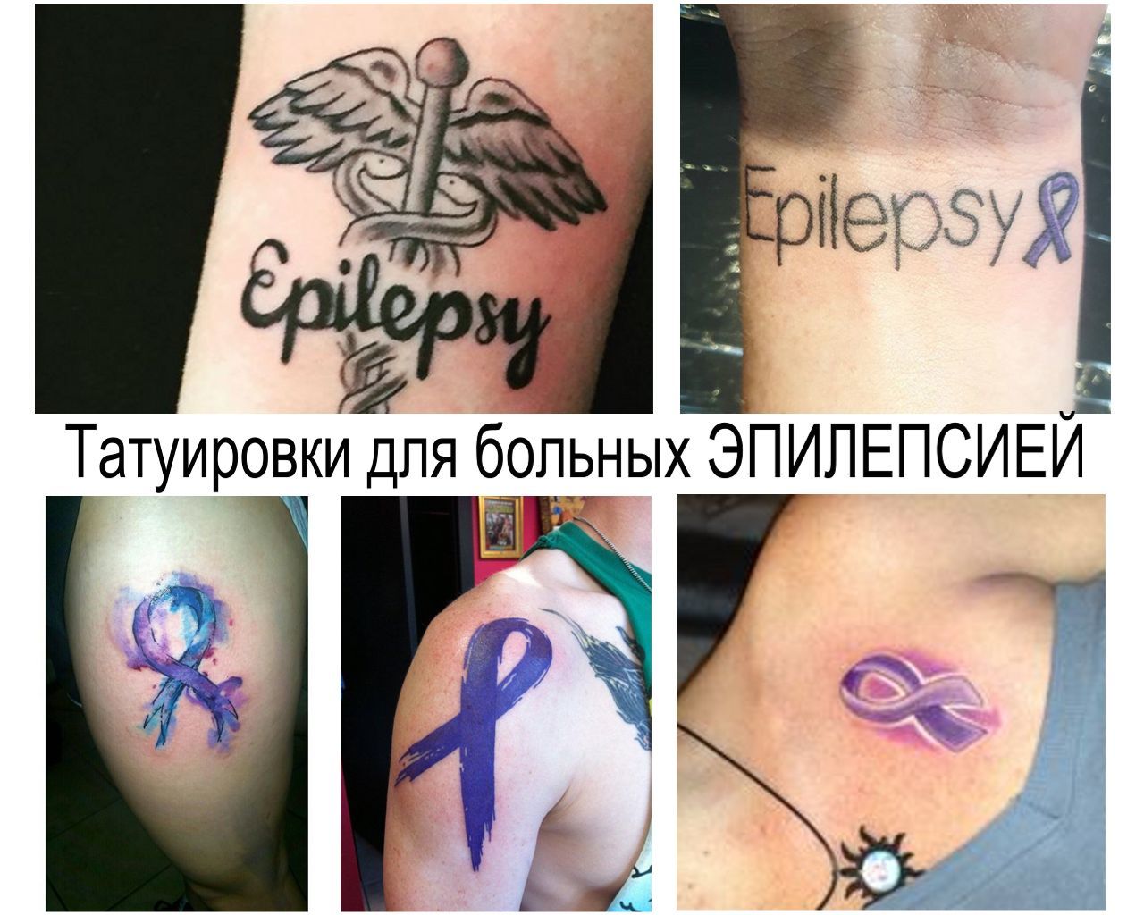 Татуировки эпилептиков