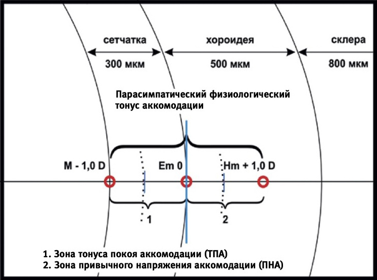 H 52.5 нарушения аккомодации